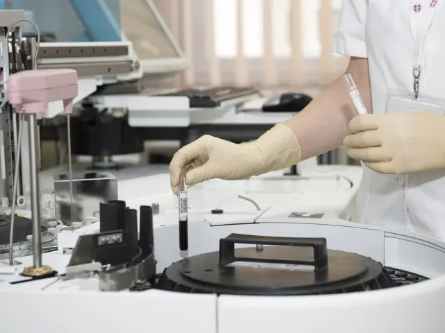 Particle Size Analysis Methods
